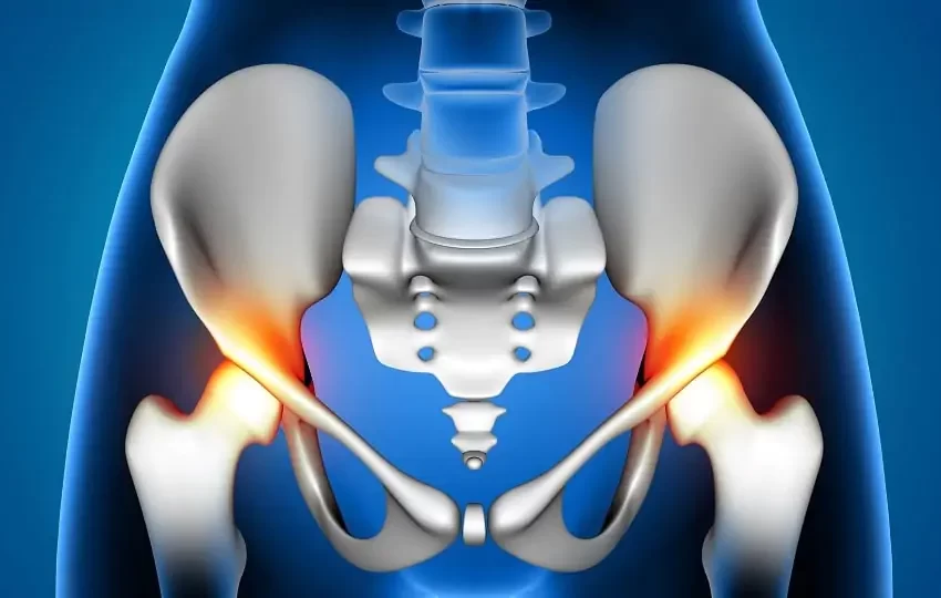  Frequência sonora ideal para fixação da copa acetabular não cimentada na ATQ?