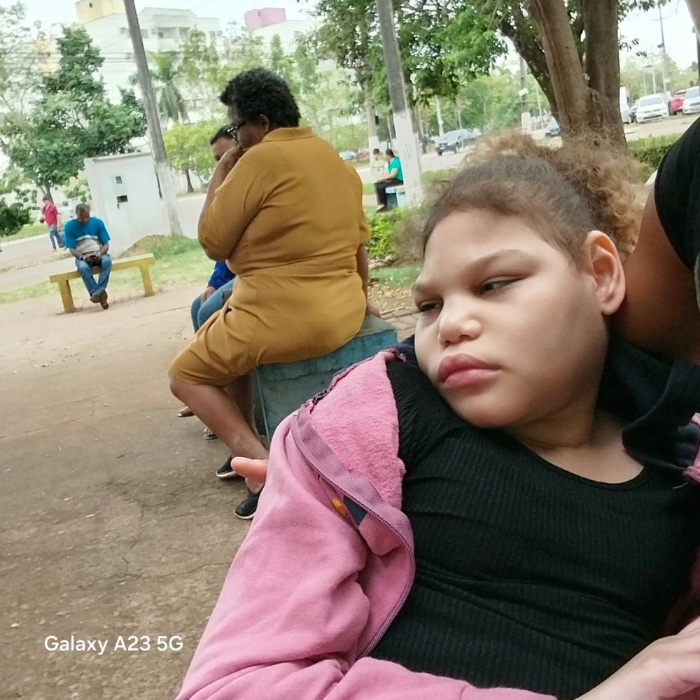 Jaru: Mãe de Menina com Microcefalia Denúncia Abandono em Consultas em Porto Velho; “Passo o Dia Todo com Minha Filha no Colo por Falta de Cadeira de Rodas”