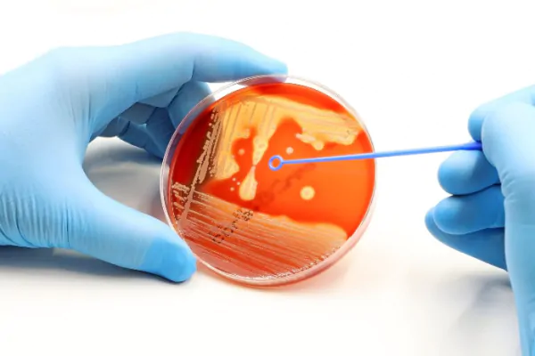 Bacteremia por Staphylococcus aureus: quais as controvérsias no manejo atual?