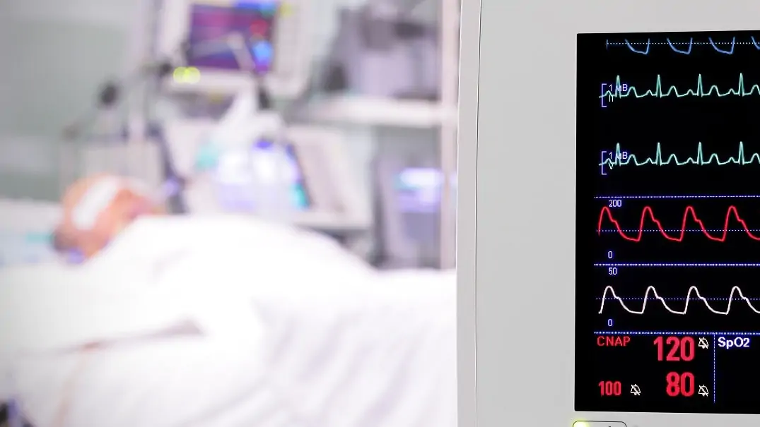 American Heart Association atualiza recomendações do suporte avançado de vida