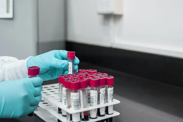 Terapia antitrombótica na dengue: como agir?