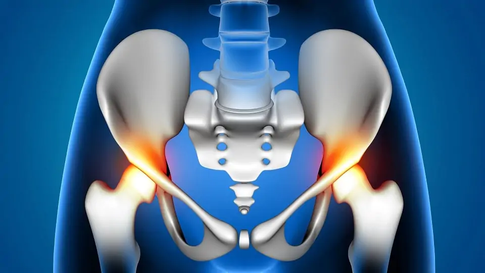 Frequência sonora ideal para fixação da copa acetabular não cimentada na ATQ?