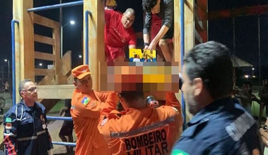 Em Rondônia, criança tem as costas perfuradas por estaca de madeira em brinquedo de praça pública