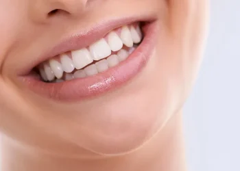 4 alimentos que ajudam a deixar os dentes mais brancos