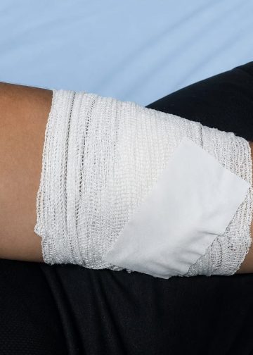 Jovem de 15 anos sofre ataque a fachadas de envolvimento pelo próprio pai na área rural de São Miguel do Guaporé