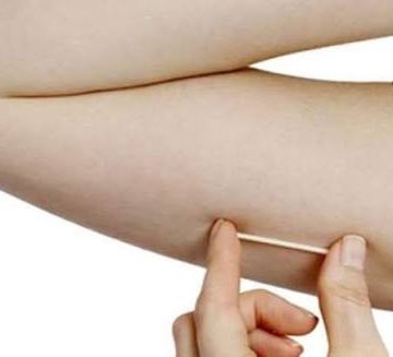 NOVIDADE NA SAÚDE DA MULHER EM MACHADINHO D’OESTE!
