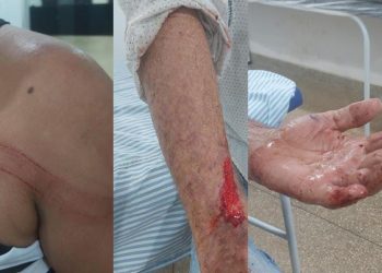Após agredir o pai e a companheira dele, homem foge em Costa Marques